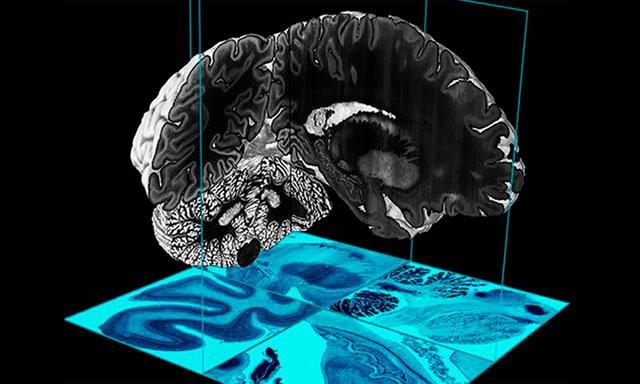 Científicos crean un modelo en 3D del cerebro humano